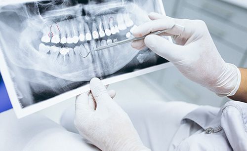 Dental